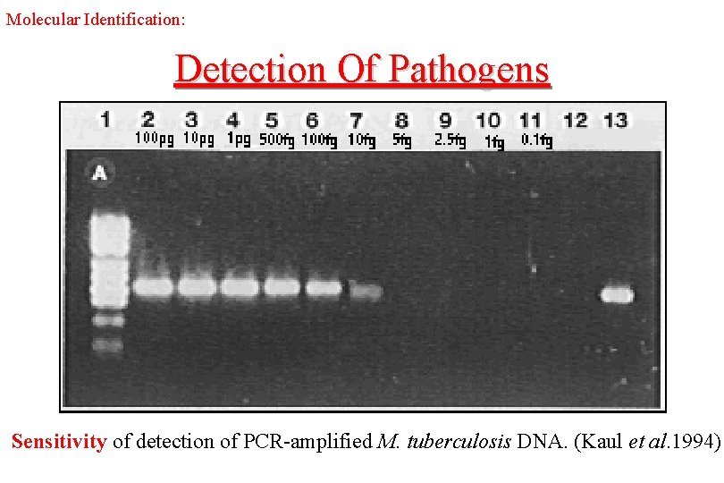 Molecular Identification: Detection Of Pathogens Sensitivity of detection of PCR-amplified M. tuberculosis DNA. (Kaul