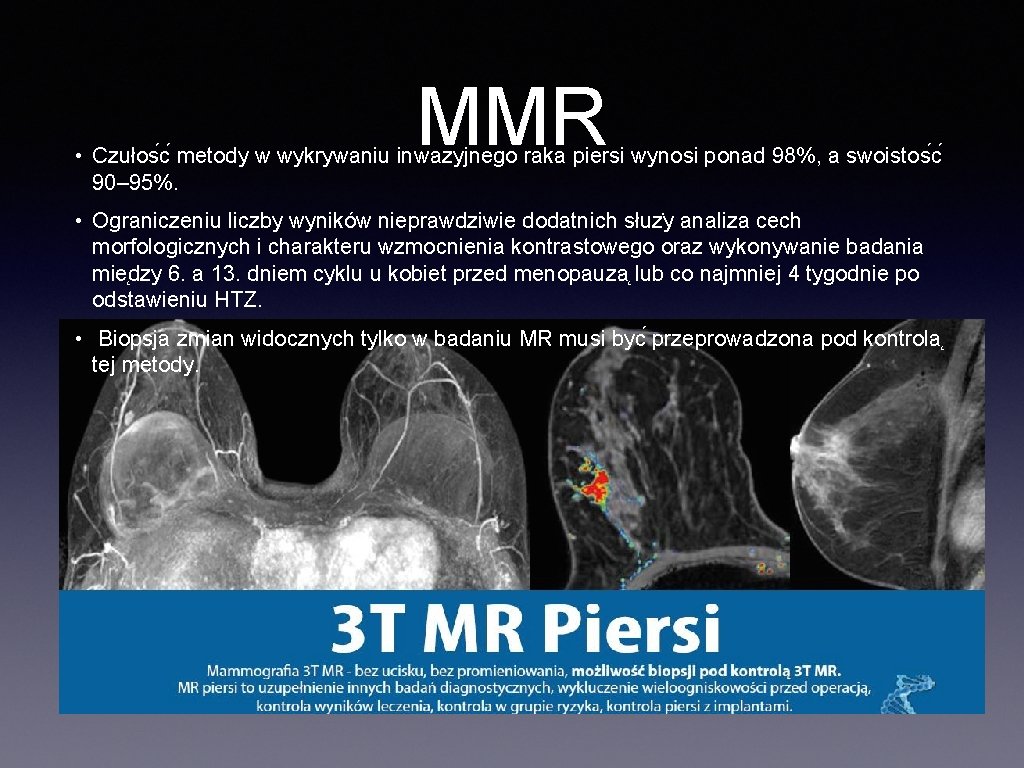 MMR • Czułos c metody w wykrywaniu inwazyjnego raka piersi wynosi ponad 98%, a