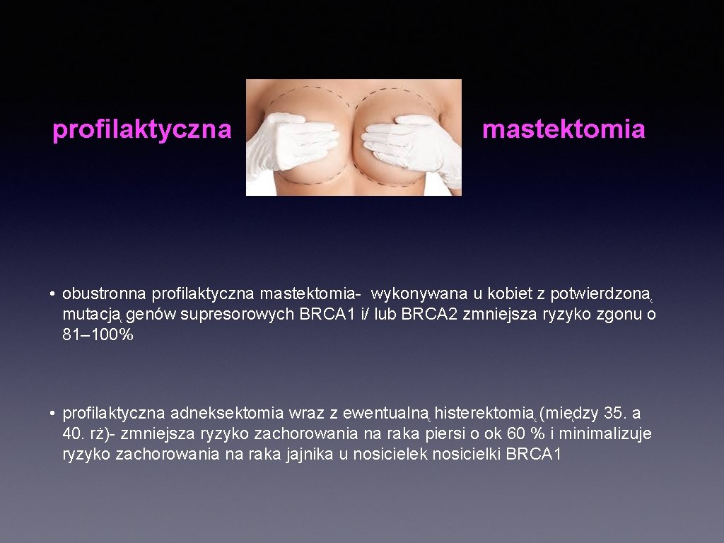 profilaktyczna mastektomia • obustronna profilaktyczna mastektomia- wykonywana u kobiet z potwierdzona mutacja genów supresorowych