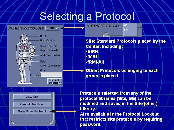 Selecting a Protocol Site: Standard Protocols placed by the Center. Including: • BIRN •