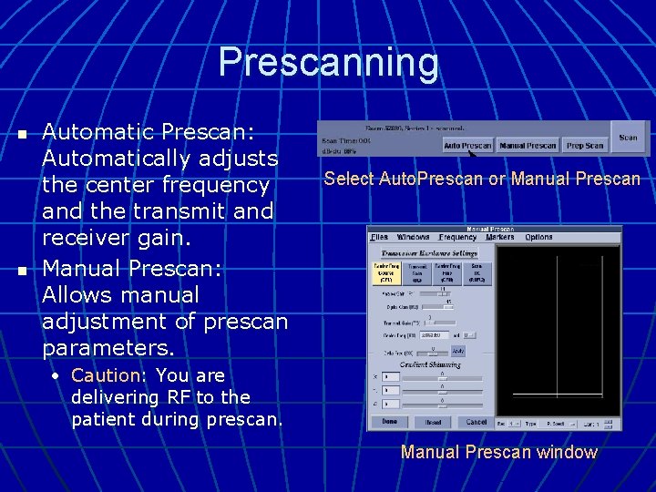 Prescanning n n Automatic Prescan: Automatically adjusts the center frequency and the transmit and