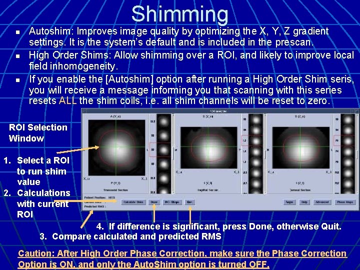 Shimming n n n Autoshim: Improves image quality by optimizing the X, Y, Z