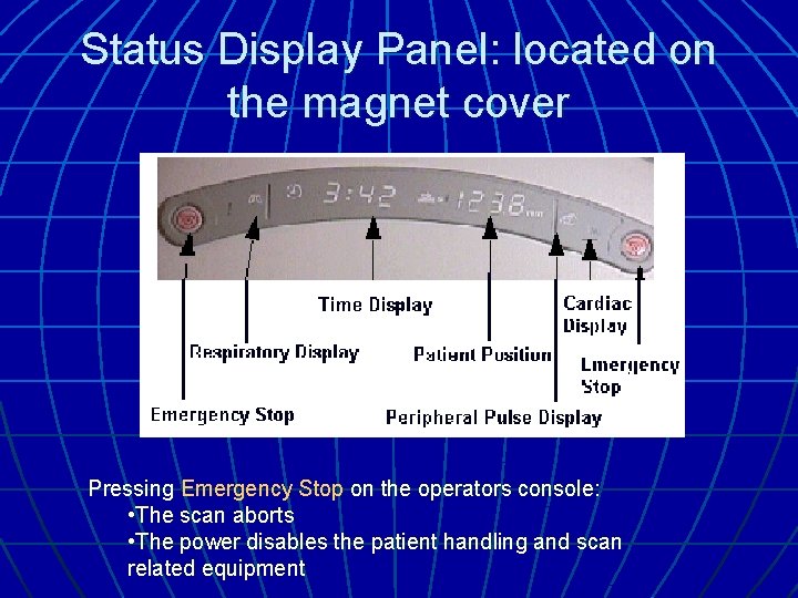 Status Display Panel: located on the magnet cover Pressing Emergency Stop on the operators