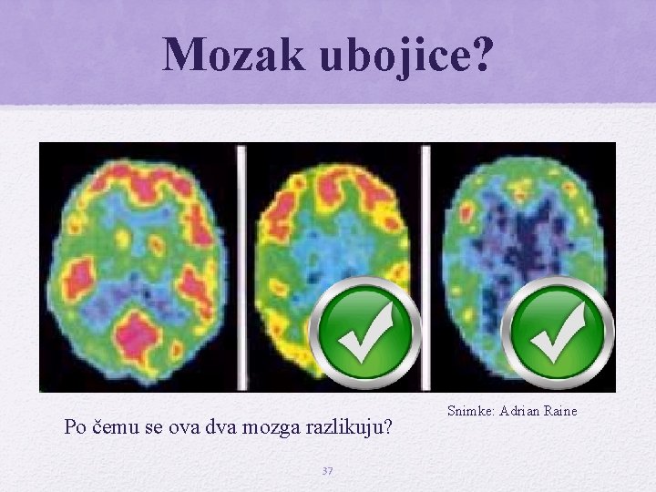Mozak ubojice? Po čemu se ova dva mozga razlikuju? 37 Snimke: Adrian Raine Mozak ubojice? Po čemu se ova dva mozga razlikuju? 37 Snimke: Adrian Raine