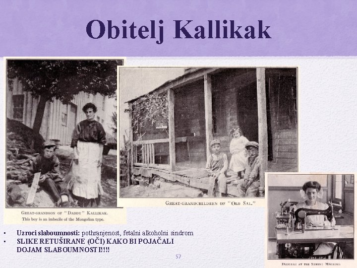 Obitelj Kallikak • • Uzroci slaboumnosti: pothranjenost, fetalni alkoholni sindrom SLIKE RETUŠIRANE (OČI) KAKO