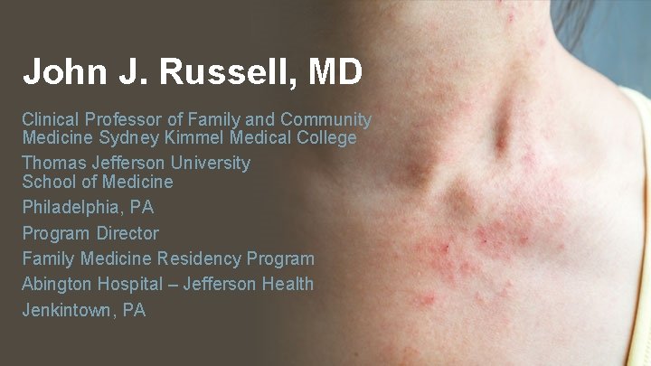 John J. Russell, MD Clinical Professor of Family and Community Medicine Sydney Kimmel Medical