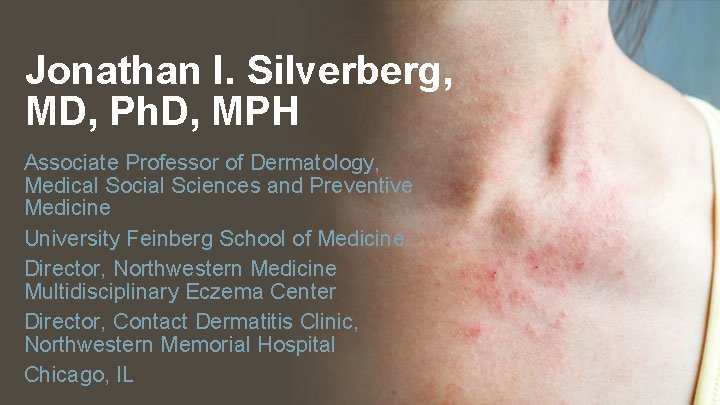 Jonathan I. Silverberg, MD, Ph. D, MPH Associate Professor of Dermatology, Medical Social Sciences