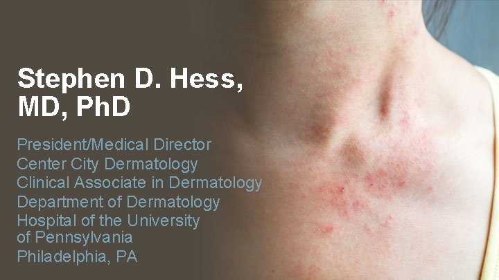 Stephen D. Hess, MD, Ph. D President/Medical Director Center City Dermatology Clinical Associate in