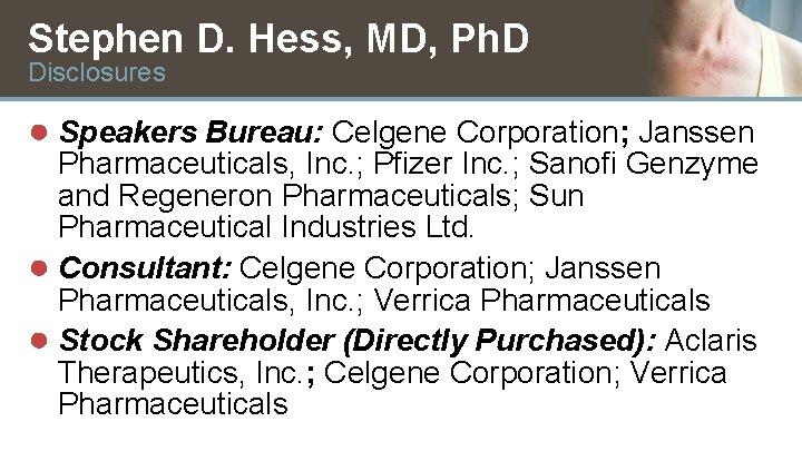Stephen D. Hess, MD, Ph. D Disclosures ● Speakers Bureau: Celgene Corporation; Janssen Pharmaceuticals,