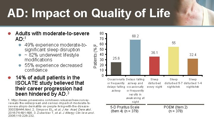 AD: Impact on Quality of Life AD: 1 ● 49% experience moderate-tosignificant sleep disruption