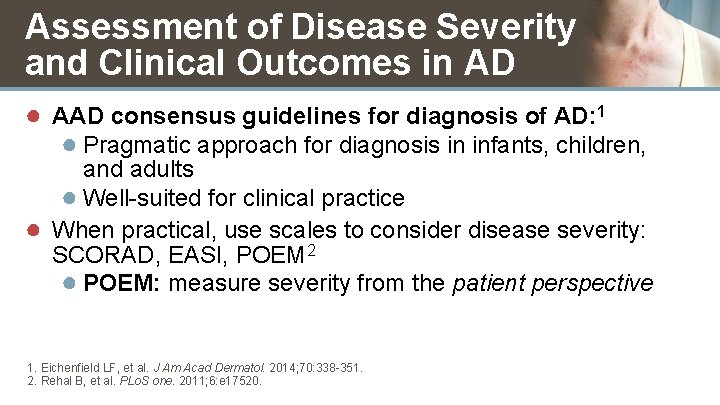 Assessment of Disease Severity and Clinical Outcomes in AD ● AAD consensus guidelines for