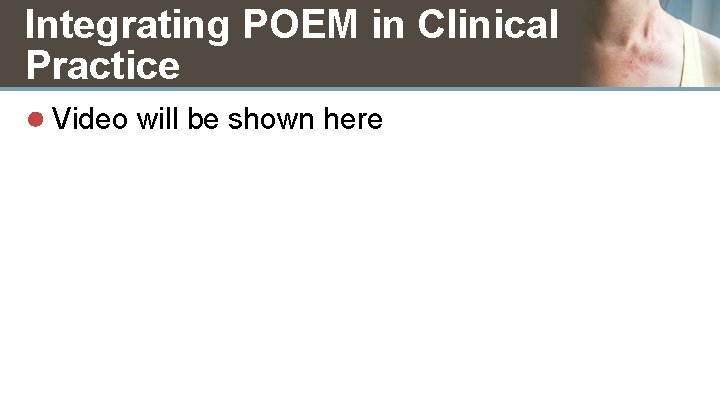 Integrating POEM in Clinical Practice ● Video will be shown here 