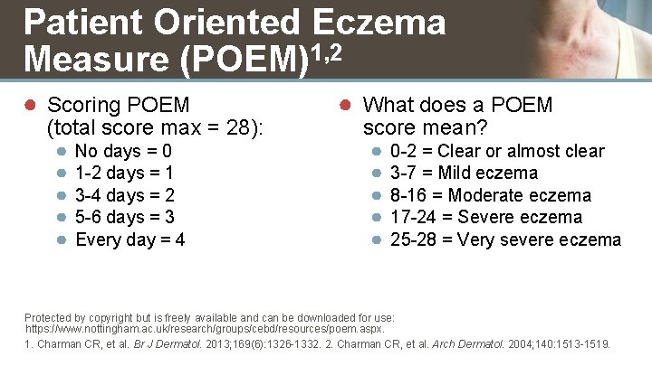 Patient Oriented Eczema Measure (POEM)1, 2 ● Scoring POEM (total score max = 28):