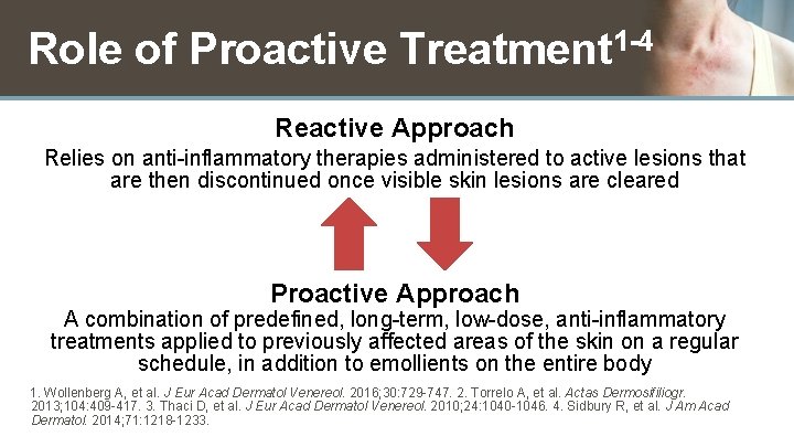 Role of Proactive Treatment 1 -4 Reactive Approach Relies on anti-inflammatory therapies administered to
