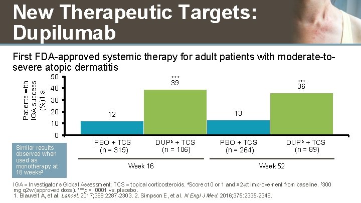 New Therapeutic Targets: Dupilumab Patients with IGA success (%)1, a First FDA-approved systemic therapy