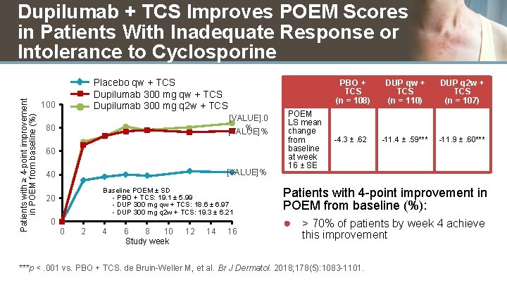 Patients with ≥ 4 -point improvement in POEM from baseline (%) Dupilumab + TCS