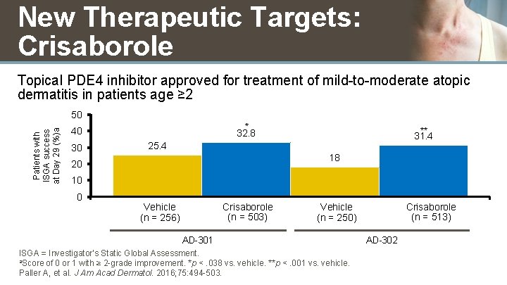 New Therapeutic Targets: Crisaborole Topical PDE 4 inhibitor approved for treatment of mild-to-moderate atopic