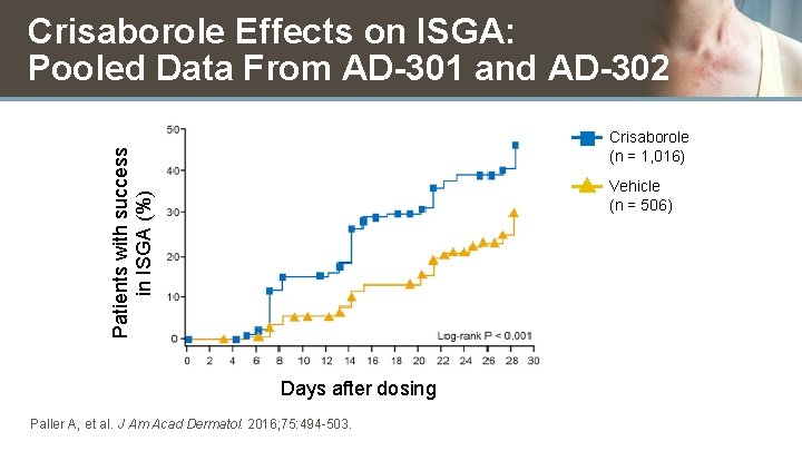 Crisaborole Effects on ISGA: Pooled Data From AD-301 and AD-302 Patients with success in