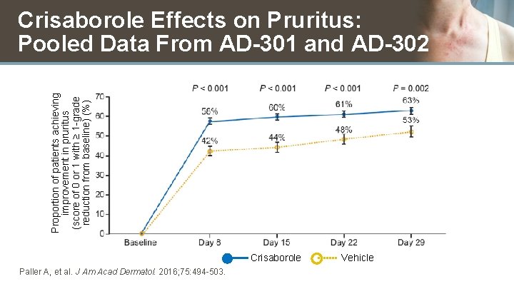 Proportion of patients achieving improvement in pruritus (score of 0 or 1 with ≥