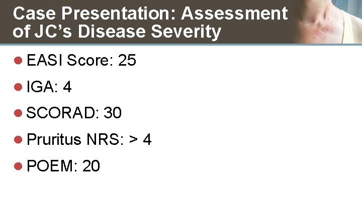 Case Presentation: Assessment of JC’s Disease Severity ● EASI Score: 25 ● IGA: 4
