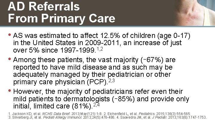 AD Referrals From Primary Care • AS was estimated to affect 12. 5% of