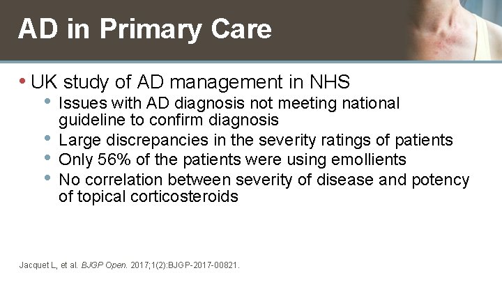 AD in Primary Care • UK study of AD management in NHS • Issues