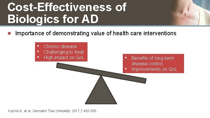 Cost-Effectiveness of Biologics for AD ● Importance of demonstrating value of health care interventions