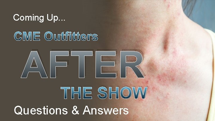 Coming Up. . . CME Outfitters AFTER THE SHOW Questions & Answers 
