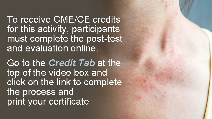 To receive CME/CE credits for this activity, participants must complete the post-test and evaluation