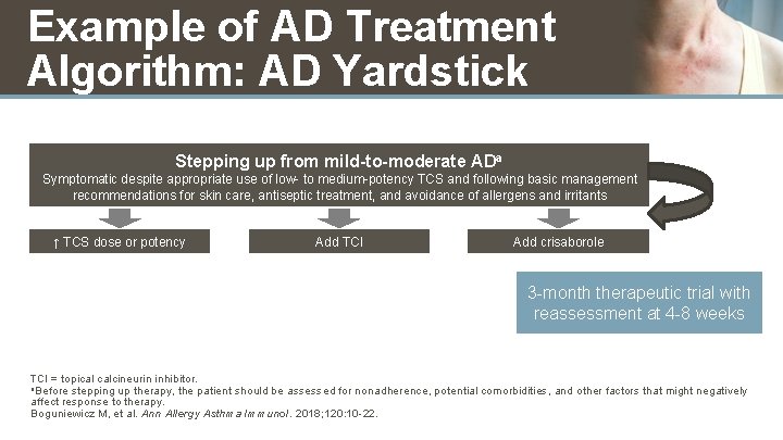 Example of AD Treatment Algorithm: AD Yardstick Stepping up from mild-to-moderate ADa Symptomatic despite