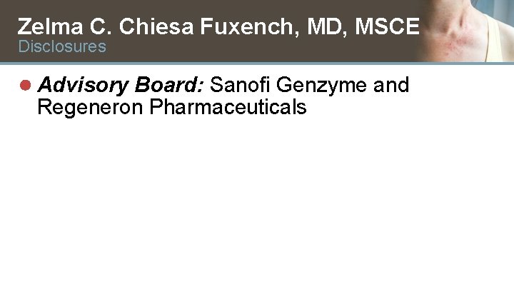 Zelma C. Chiesa Fuxench, MD, MSCE Disclosures ● Advisory Board: Sanofi Genzyme and Regeneron