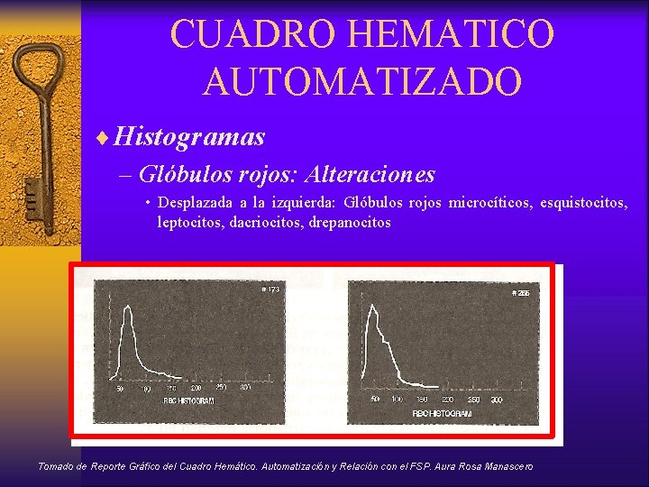 CUADRO HEMATICO AUTOMATIZADO ¨Histogramas – Glóbulos rojos: Alteraciones • Desplazada a la izquierda: Glóbulos