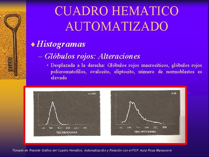 CUADRO HEMATICO AUTOMATIZADO ¨Histogramas – Glóbulos rojos: Alteraciones • Desplazada a la derecha: Glóbulos