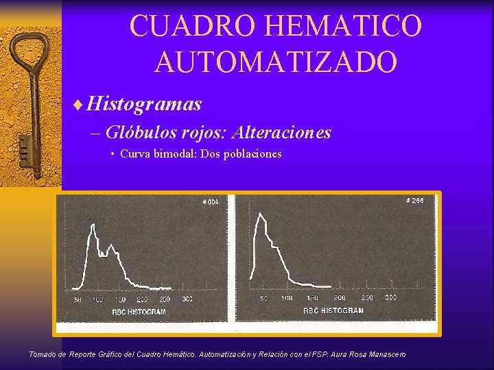 CUADRO HEMATICO AUTOMATIZADO ¨Histogramas – Glóbulos rojos: Alteraciones • Curva bimodal: Dos poblaciones Tomado