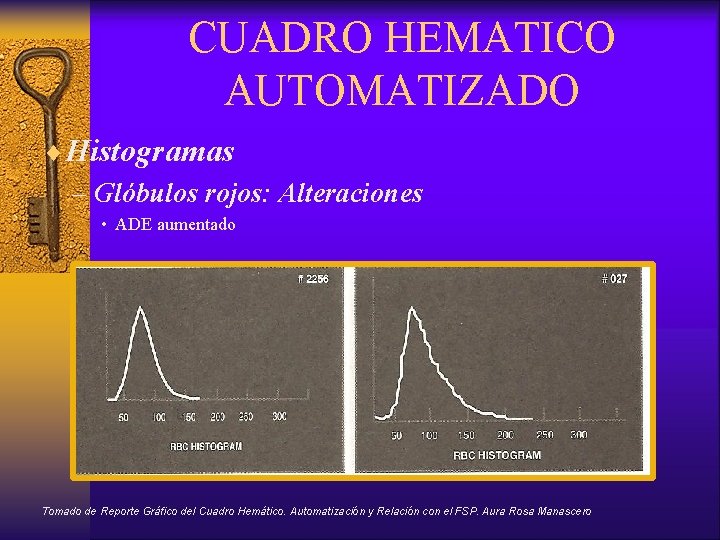 CUADRO HEMATICO AUTOMATIZADO ¨Histogramas – Glóbulos rojos: Alteraciones • ADE aumentado Tomado de Reporte