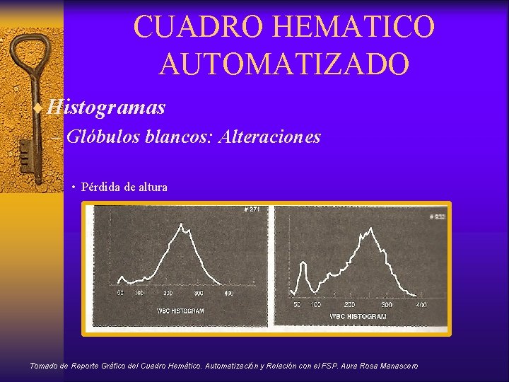 CUADRO HEMATICO AUTOMATIZADO ¨Histogramas – Glóbulos blancos: Alteraciones • Pérdida de altura Tomado de
