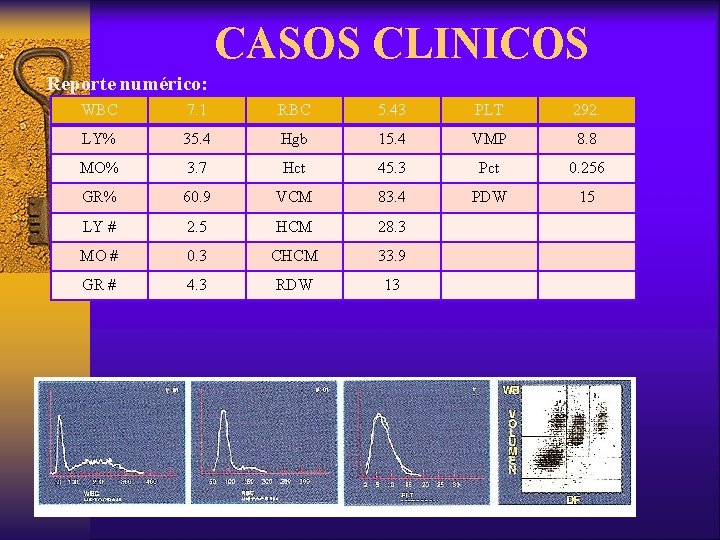 CASOS CLINICOS Reporte numérico: WBC 7. 1 RBC 5. 43 PLT 292. LY% 35.