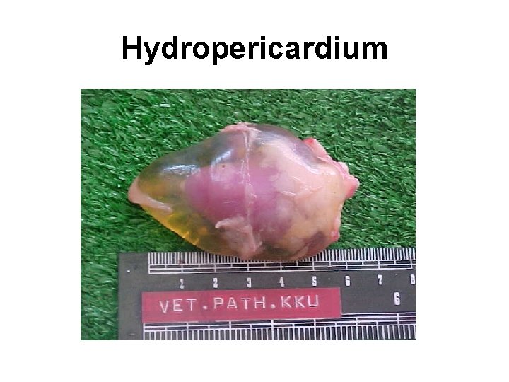 Hydropericardium 