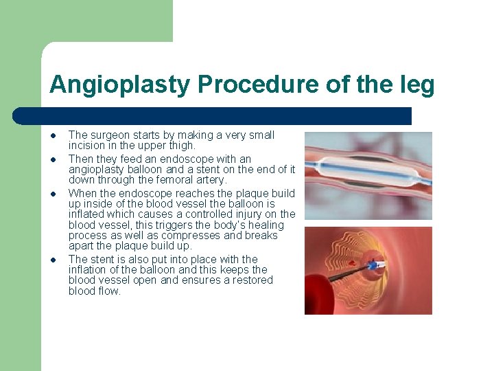 Angioplasty Procedure of the leg l l The surgeon starts by making a very