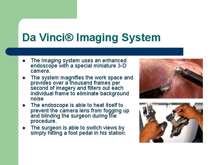 Da Vinci® Imaging System l l The Imaging system uses an enhanced endoscope with