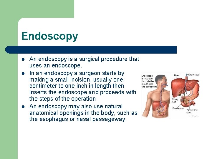 Endoscopy l l l An endoscopy is a surgical procedure that uses an endoscope.