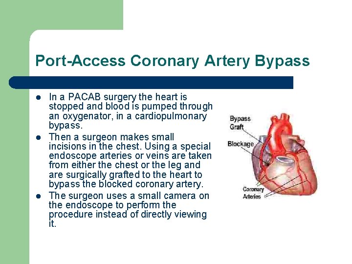 Port-Access Coronary Artery Bypass l l l In a PACAB surgery the heart is