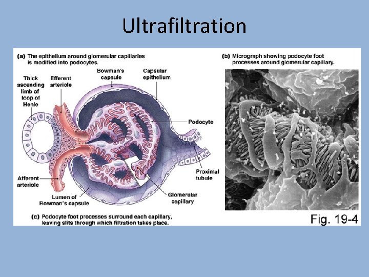 Ultrafiltration 