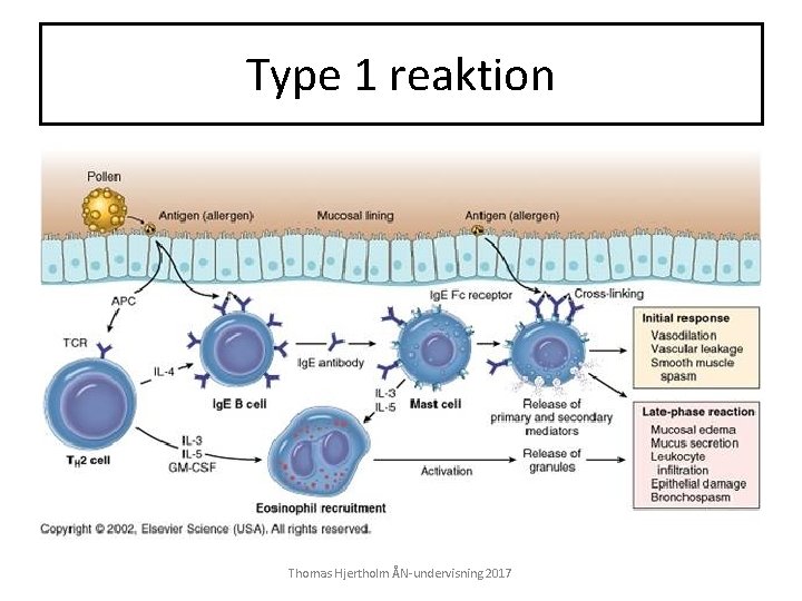 Type 1 reaktion Thomas Hjertholm ÅN-undervisning 2017 