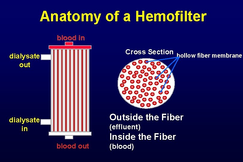 Anatomy of a Hemofilter blood in Cross Section hollow fiber membrane dialysate out Outside Anatomy of a Hemofilter blood in Cross Section hollow fiber membrane dialysate out Outside