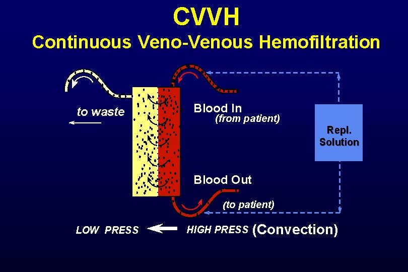 CVVH Continuous Veno-Venous Hemofiltration to waste Blood In (from patient) Repl. Solution Blood Out