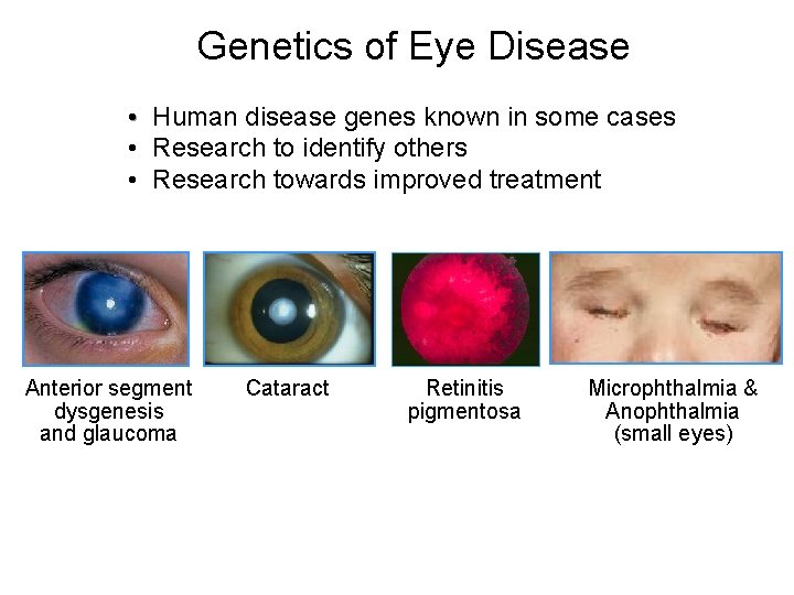 Genetics of Eye Disease • Human disease genes known in some cases • Research