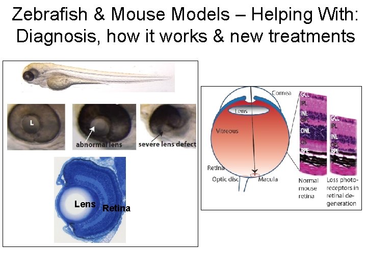 Zebrafish & Mouse Models – Helping With: Diagnosis, how it works & new treatments