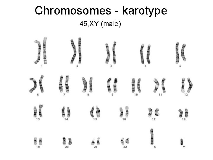 Chromosomes - karotype 46, XY (male) 