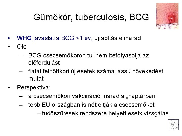 Gümőkór, tuberculosis, BCG • • • WHO javaslatra BCG <1 év, újraoltás elmarad Ok: